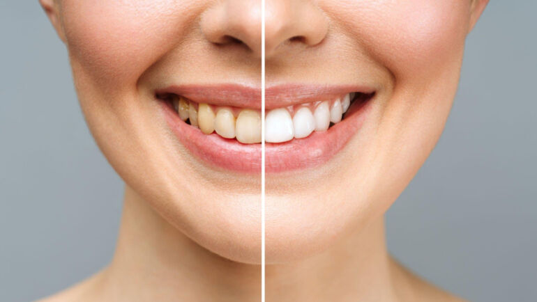 Cosmetic Dentist St Andrews Beach: Cosmetic Dentist Treatment